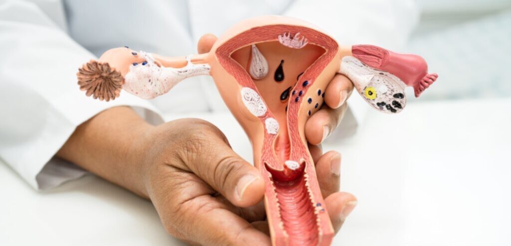 شكل الجهاز التناسلي الأنثوي