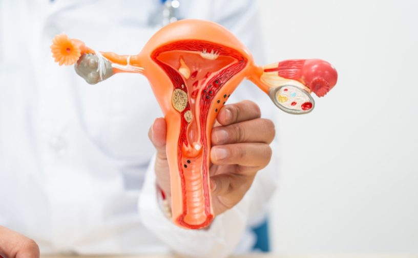 علاج التهاب المهبل بعد العلاقة الزوجية