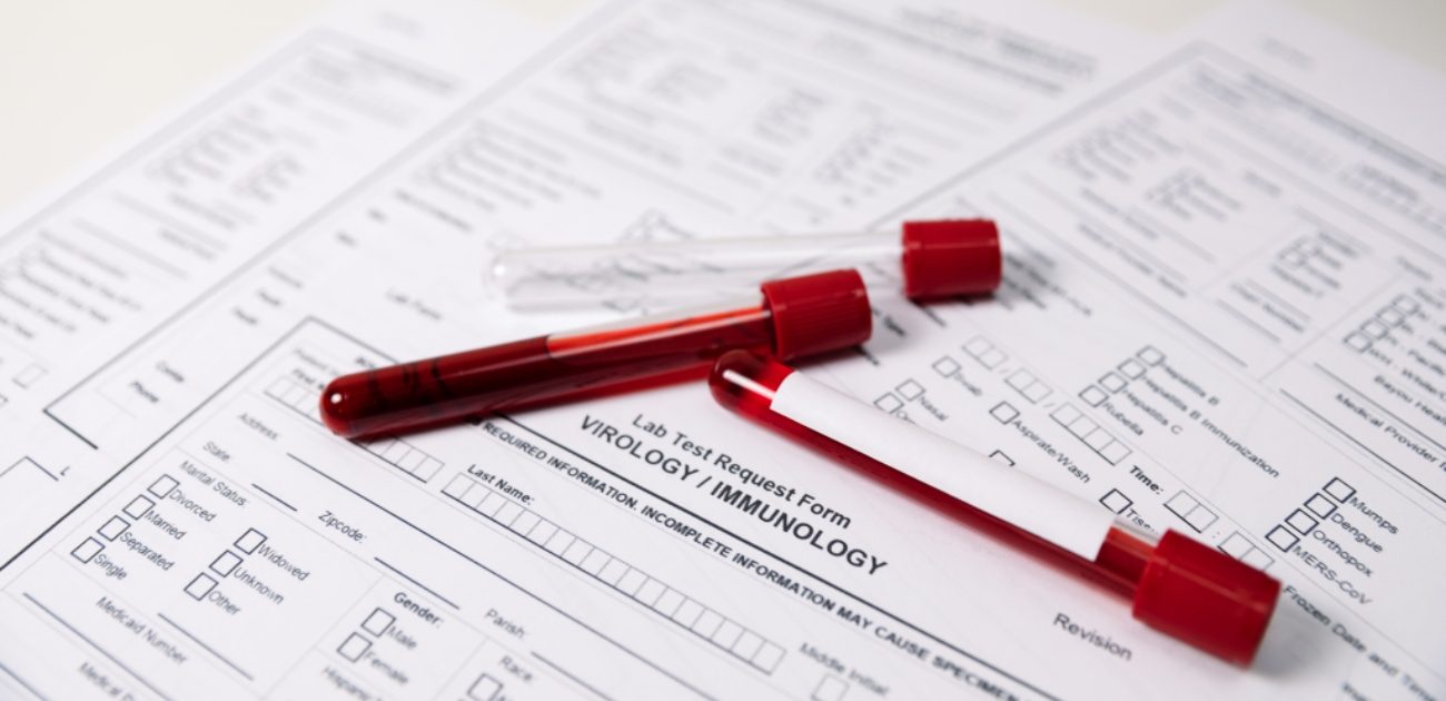 أنابيب من الدم في المختبر