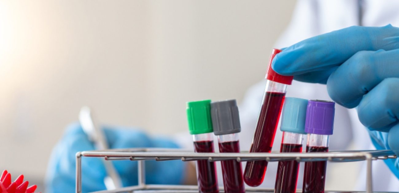 أنابيب من الدم في المختبر