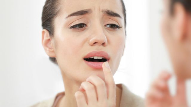ما علاج الحبوب في الفم واسبابها