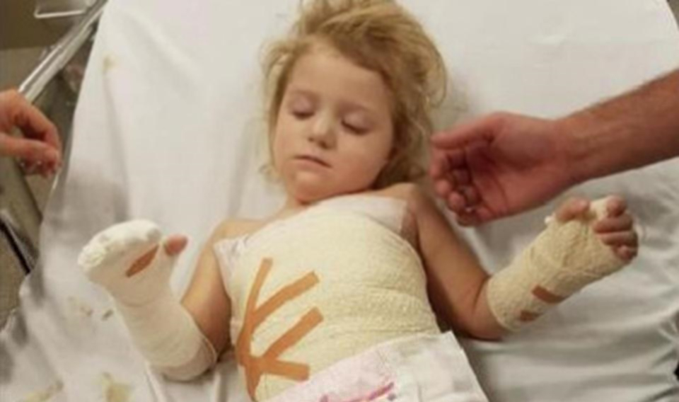 طفلة بعمر 3 سنوات كادت أن تخسر يدها بسبب غرض شائع