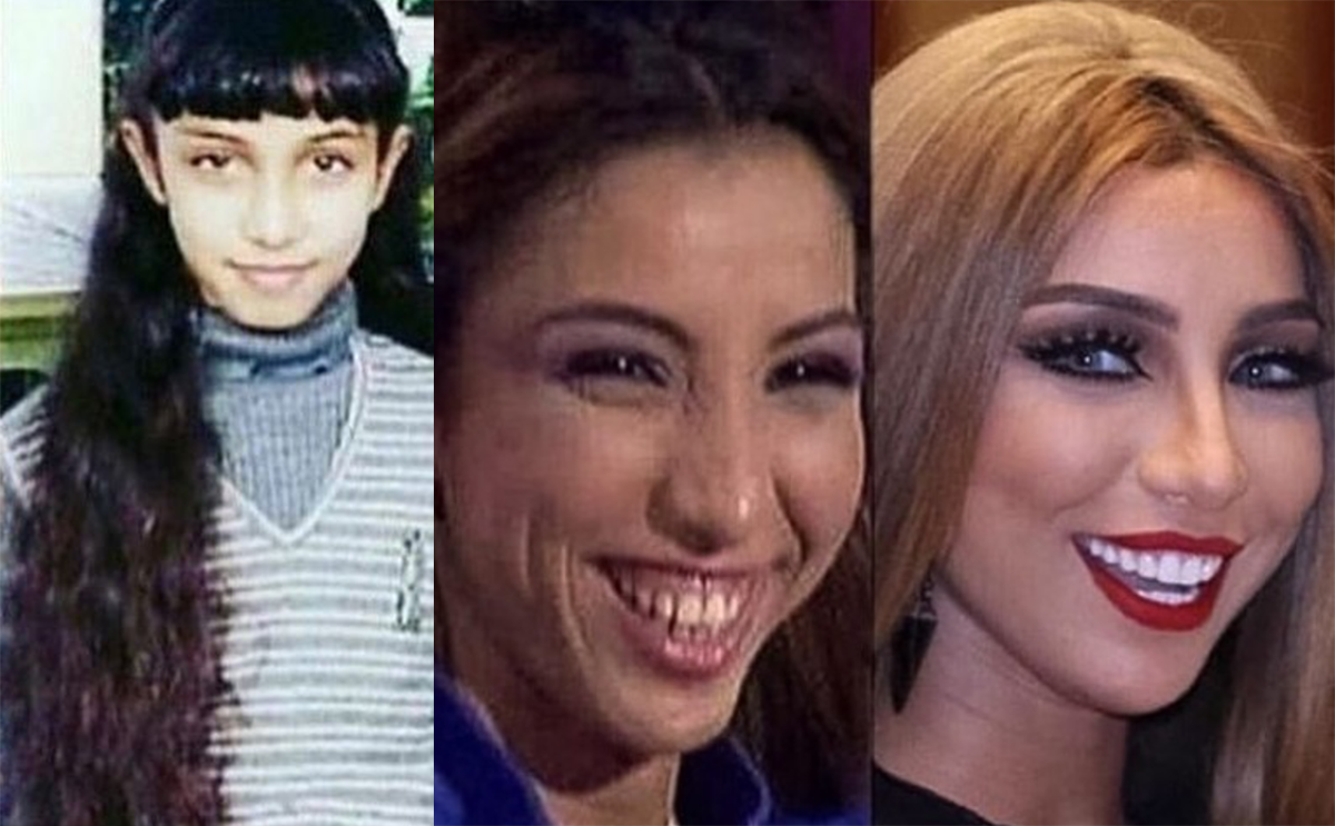 دنيا بطمة قبل الشهرة وبعدها